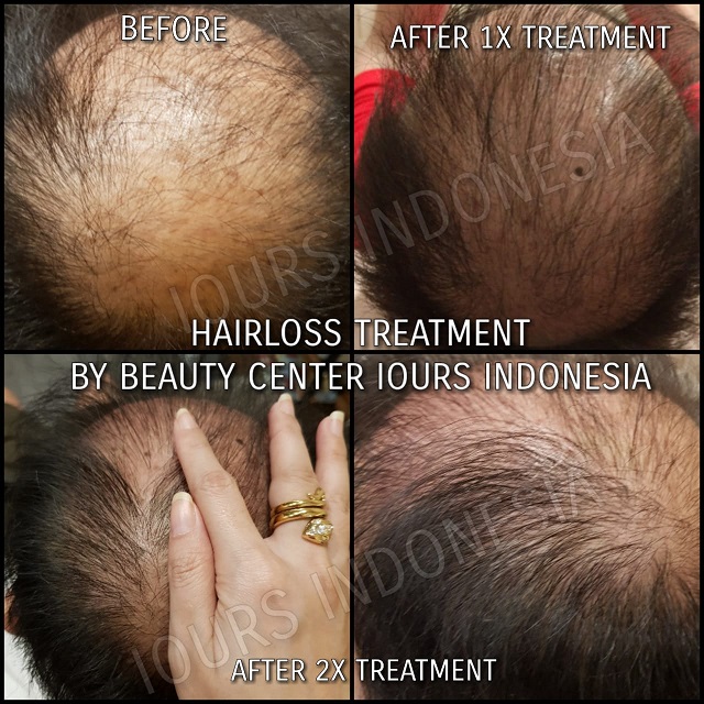 Beauty Treatment